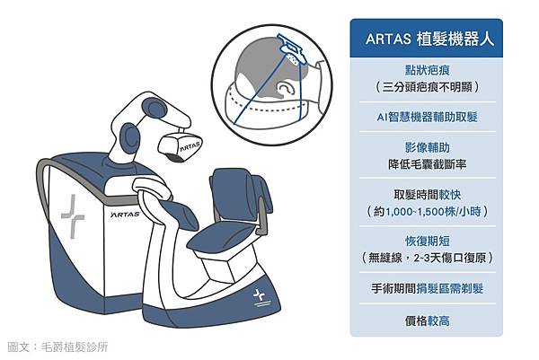 ARTAS機器人植髮優點