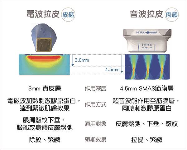 音波拉皮和電波拉提的差別-美麗新診所.jpg