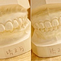 林口牙醫推薦-牙周植牙專科-康澤牙醫-牙齦快爛掉前，終於確定了牙周病治療診所，牙周植牙專科-江明學醫師推薦99.jpg