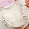 林口牙醫推薦-牙周植牙專科-康澤牙醫-牙齦快爛掉前，終於確定了牙周病治療診所，牙周植牙專科-江明學醫師推薦666.jpg