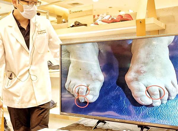 健康鞋|德國骨科醫生推薦Berkemann初體驗。原本一直喊腳痛的扁平足老公,穿上新鞋不再半夜喊腳抽筋或腳底痛//真實故事//
