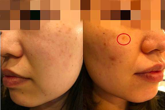 嘉義醫學美容 台南雷射除斑 郭健軍皮膚科診所 健康跟著走