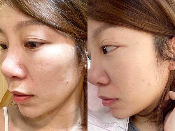 抗老 Orbis芯生悠 編輯連續擦一周 臉頰由凹轉膨 關鍵在 保養夠力才是真正q彈水嫩的舒適肌 蘇摸摸 編輯日常