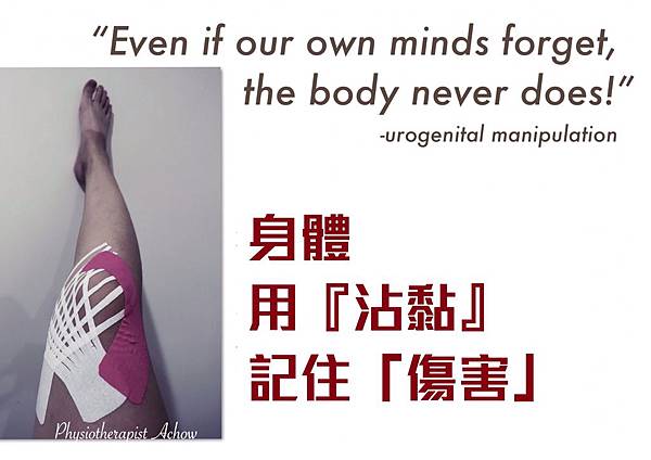 反覆腰痛?經痛?不孕?:子宮沾黏的原因、症狀、與處理方式 反覆腰痛?經痛?不孕?:子宮沾黏的原因、症狀、與處理方式