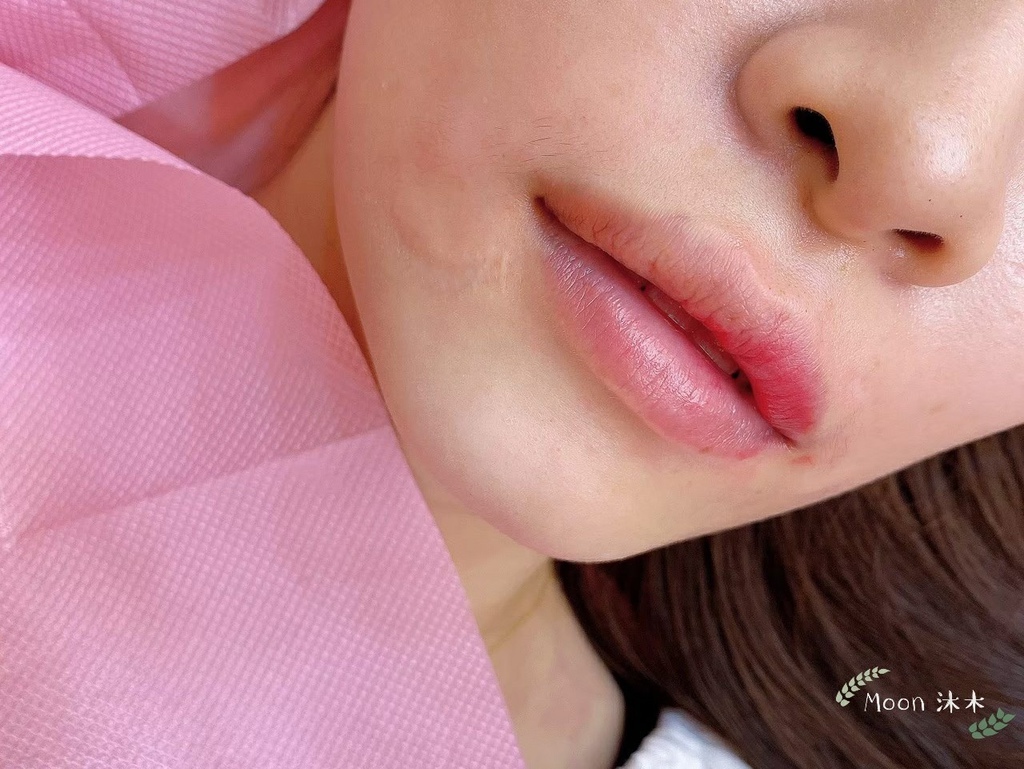 霧唇照顧 不腫霧唇 推薦 水晶唇 花瓣唇 繡唇 紋唇 霧唇顏色 韓式半永久 紋繡 東區台北霧_51.jpg 霧唇照顧 不腫霧唇 推薦 水晶唇 花瓣唇 繡唇 紋唇 霧唇顏色 韓式半永久 紋繡 東區台北霧_51.jpg