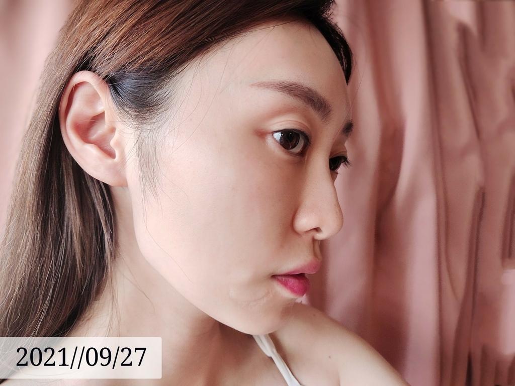 LINE_ALBUM_高雄醫美推薦 BBL寬頻光課程 高雄醫美 麗晶診所 青春光耀 恆淨痘痘 動態除毛 動_23.jpg LINE_ALBUM_高雄醫美推薦 BBL寬頻光課程 高雄醫美 麗晶診所 青春光耀 恆淨痘痘 動態除毛 動_23.jpg