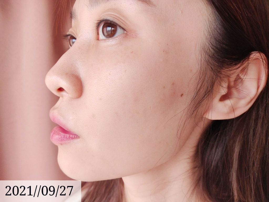 LINE_ALBUM_高雄醫美推薦 BBL寬頻光課程 高雄醫美 麗晶診所 青春光耀 恆淨痘痘 動態除毛 動_24.jpg LINE_ALBUM_高雄醫美推薦 BBL寬頻光課程 高雄醫美 麗晶診所 青春光耀 恆淨痘痘 動態除毛 動_24.jpg