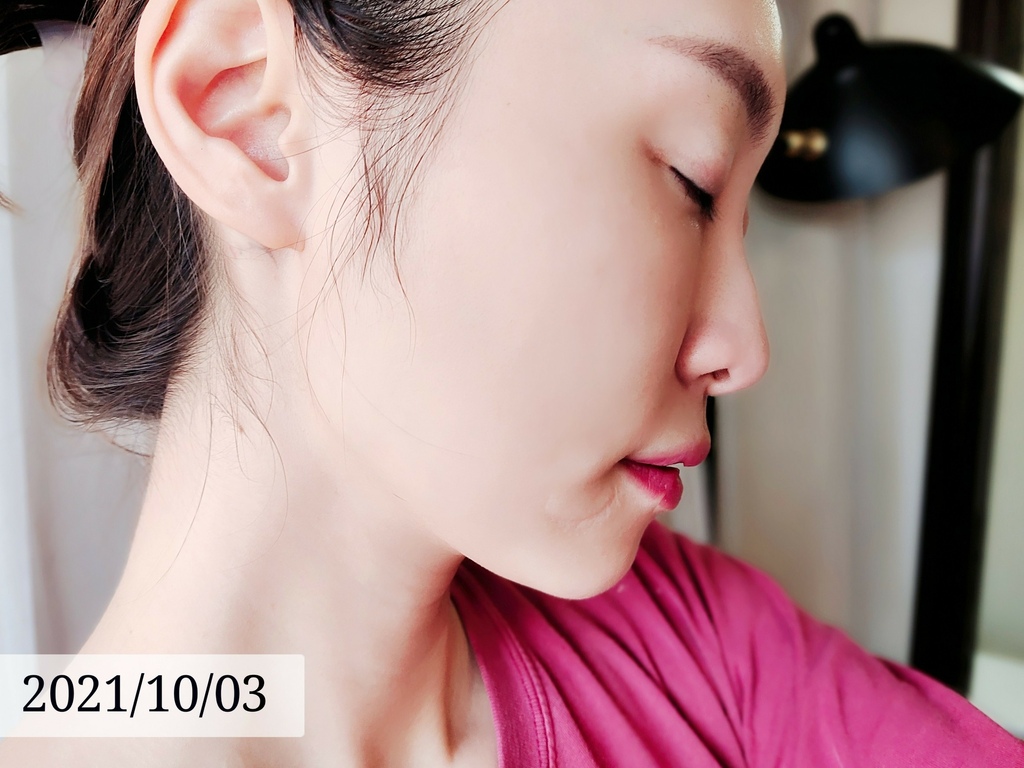 LINE_ALBUM_高雄醫美推薦 BBL寬頻光課程 高雄醫美 麗晶診所 青春光耀 恆淨痘痘 動態除毛 動_27.jpg LINE_ALBUM_高雄醫美推薦 BBL寬頻光課程 高雄醫美 麗晶診所 青春光耀 恆淨痘痘 動態除毛 動_27.jpg