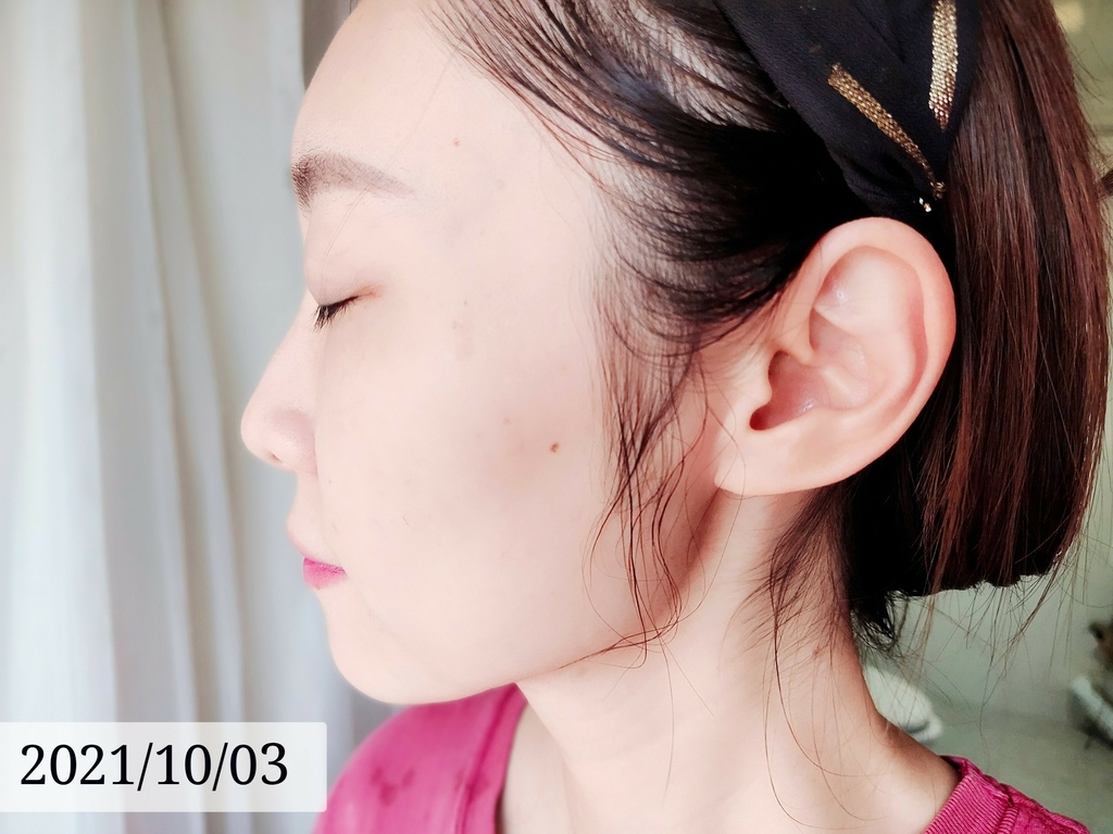 LINE_ALBUM_高雄醫美推薦 BBL寬頻光課程 高雄醫美 麗晶診所 青春光耀 恆淨痘痘 動態除毛 動_28.jpg LINE_ALBUM_高雄醫美推薦 BBL寬頻光課程 高雄醫美 麗晶診所 青春光耀 恆淨痘痘 動態除毛 動_28.jpg