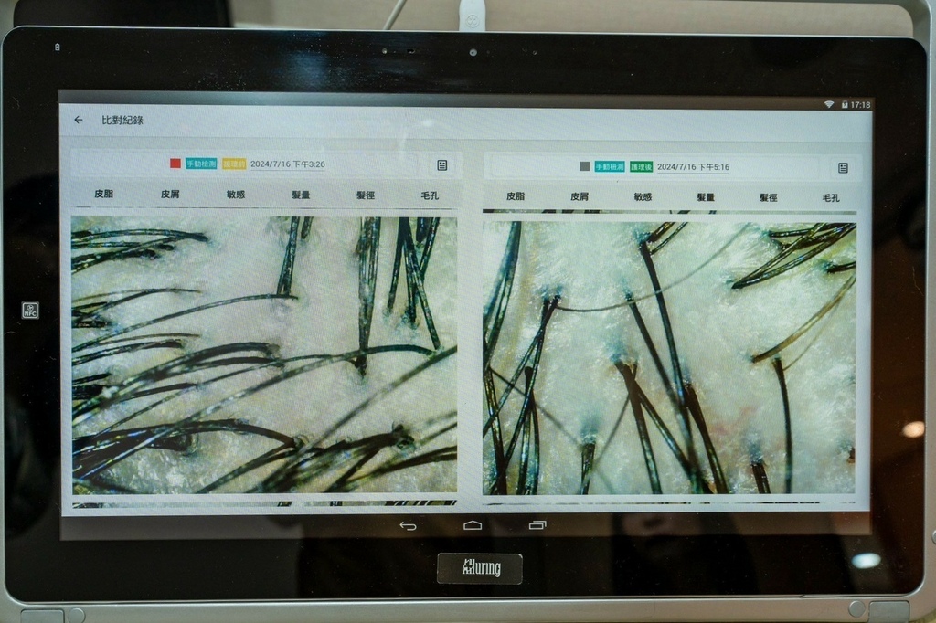 _DR CYJ健髮中心 W植萃胜玻護理課程_240723_1 (44).jpg