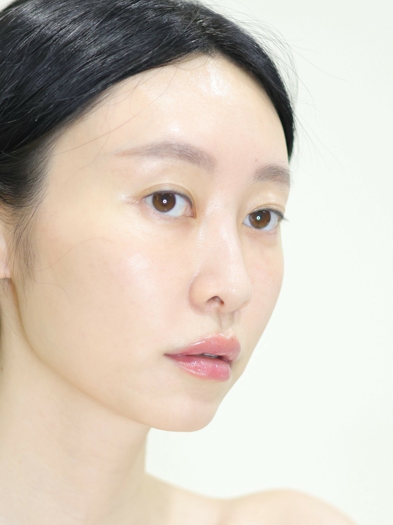 妍洵医美诊所 桃园高铁医美推荐 高级医美 服务好医美诊所 黑钻水飞梭 体验开箱25_72 (3).jpg