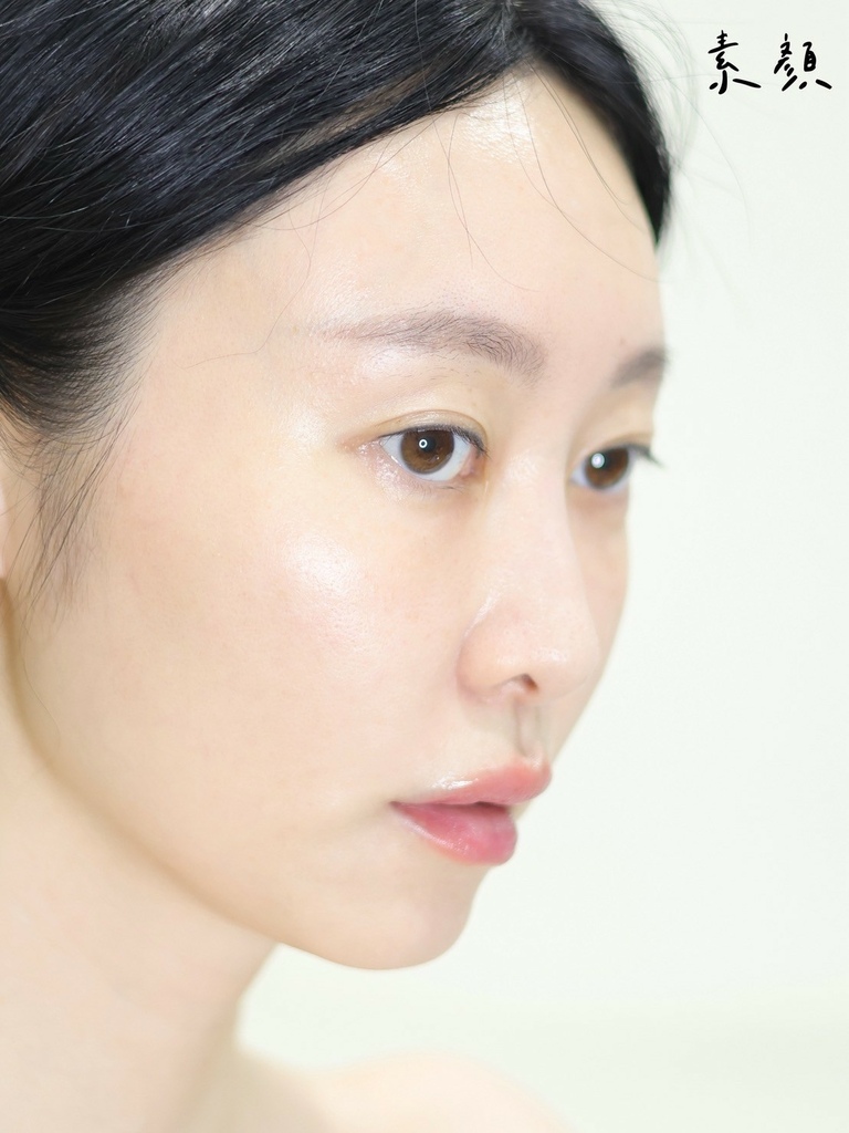 妍洵医美诊所 桃园高铁医美推荐 高级医美 服务好医美诊所 黑钻水飞梭 体验开箱25_72 (2).jpg