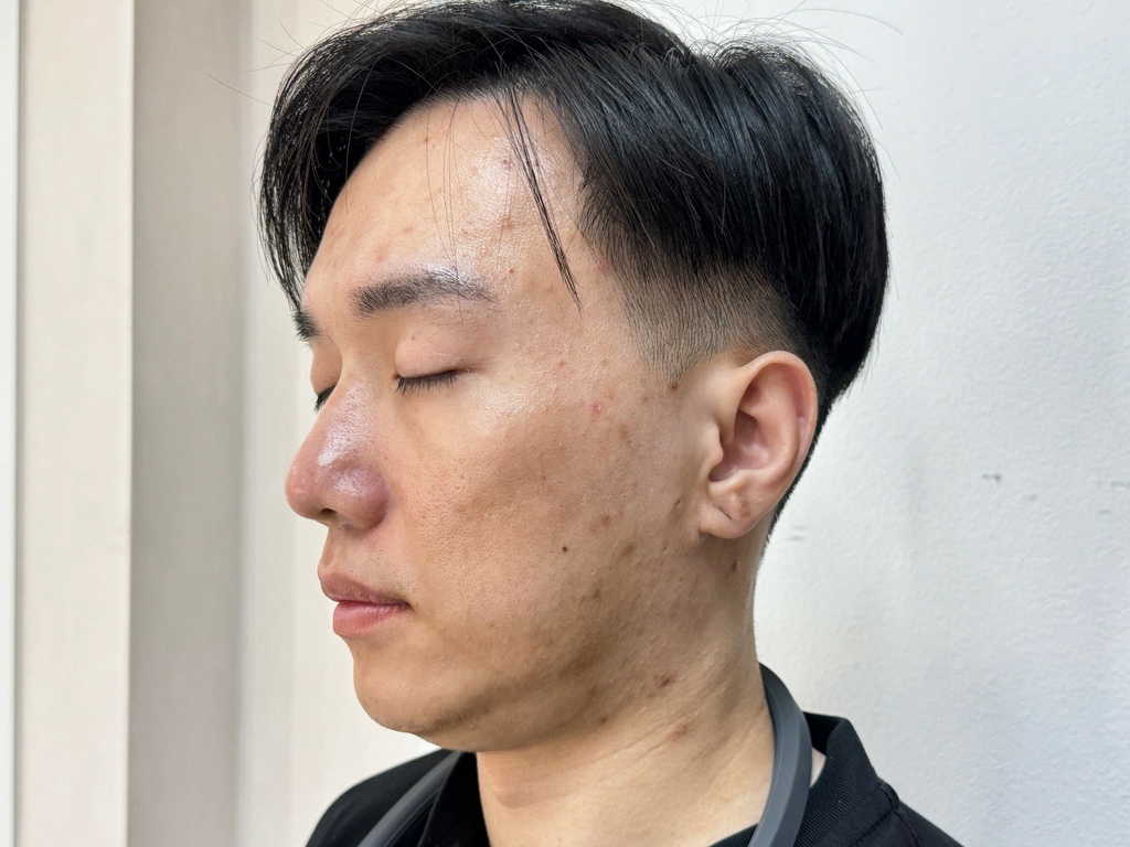 新願美學診所 大安區醫美推薦 郭毅昕醫生 探索皮秒 男生皮秒推薦 毛孔雷射 男生雷射_251203_28 (3).jpg 新願美學診所 大安區醫美推薦 郭毅昕醫生 探索皮秒 男生皮秒推薦 毛孔雷射 男生雷射_251203_28 (3).jpg