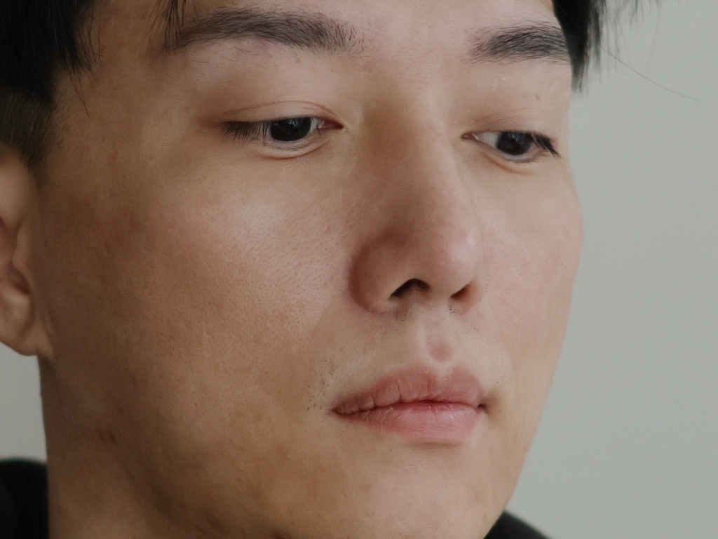 新願美學診所 大安區醫美推薦 郭毅昕醫生 探索皮秒 男生皮秒推薦 毛孔雷射 男生雷射_251203_28 (2).jpg 新願美學診所 大安區醫美推薦 郭毅昕醫生 探索皮秒 男生皮秒推薦 毛孔雷射 男生雷射_251203_28 (2).jpg