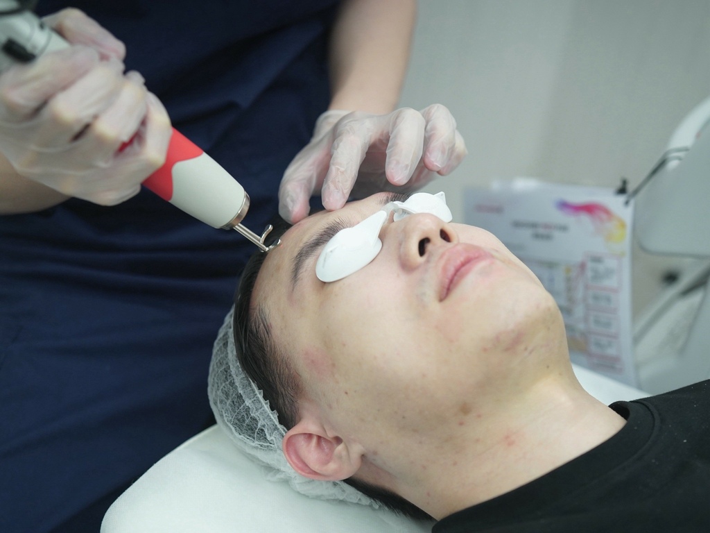 新願美學診所 大安區醫美推薦 郭毅昕醫生 探索皮秒 男生皮秒推薦 毛孔雷射 男生雷射_251203_28 (22).jpg 新願美學診所 大安區醫美推薦 郭毅昕醫生 探索皮秒 男生皮秒推薦 毛孔雷射 男生雷射_251203_28 (22).jpg