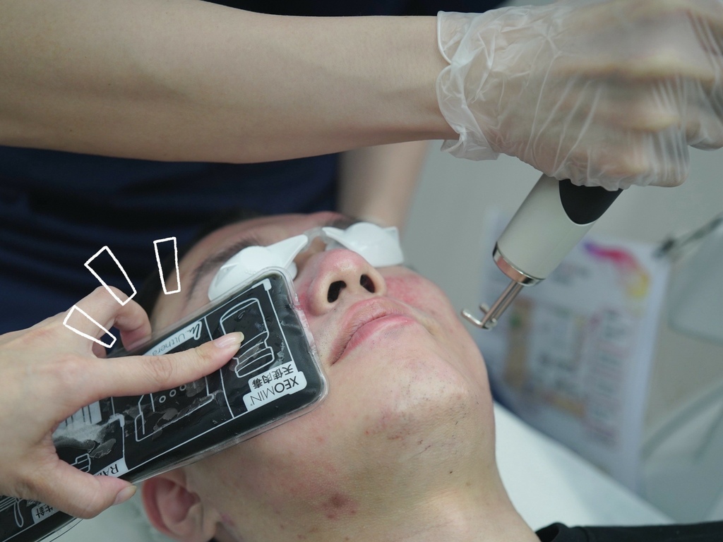 新願美學診所 大安區醫美推薦 郭毅昕醫生 探索皮秒 男生皮秒推薦 毛孔雷射 男生雷射_251203_28 (29).jpg 新願美學診所 大安區醫美推薦 郭毅昕醫生 探索皮秒 男生皮秒推薦 毛孔雷射 男生雷射_251203_28 (29).jpg