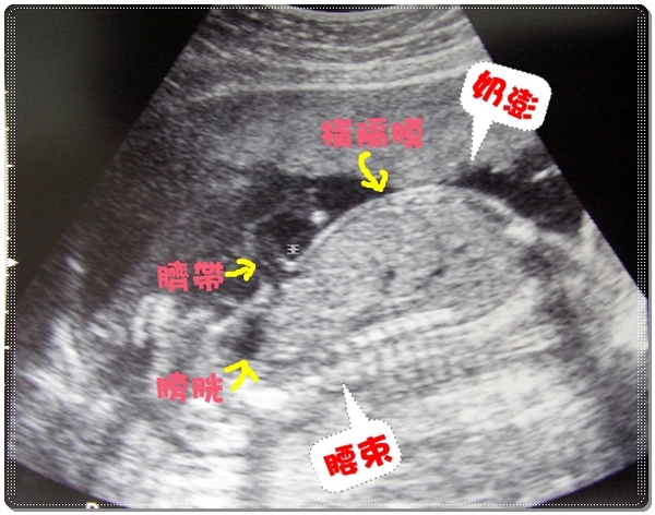 22W5D Molly好身材.JPG