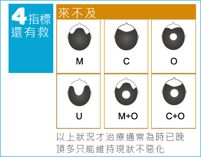 雄性禿