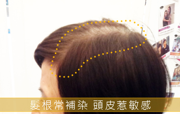 白頭髮常常要補染.jpg 白頭髮常常要補染.jpg