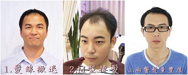 前黏後夾.jpg 前黏後夾.jpg