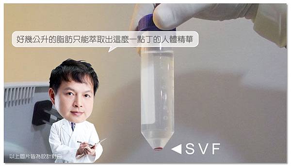 台中隆乳|台中隆乳手術06 台中隆乳|台中隆乳手術06