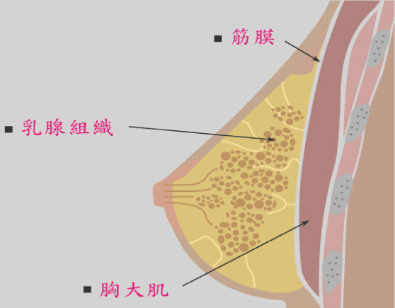 台中隆乳|台中隆乳手術11 台中隆乳|台中隆乳手術11