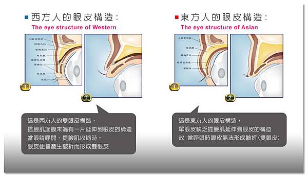 台中雙眼皮｜台中雙眼皮手術01