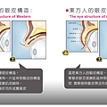 台中雙眼皮｜台中雙眼皮手術01