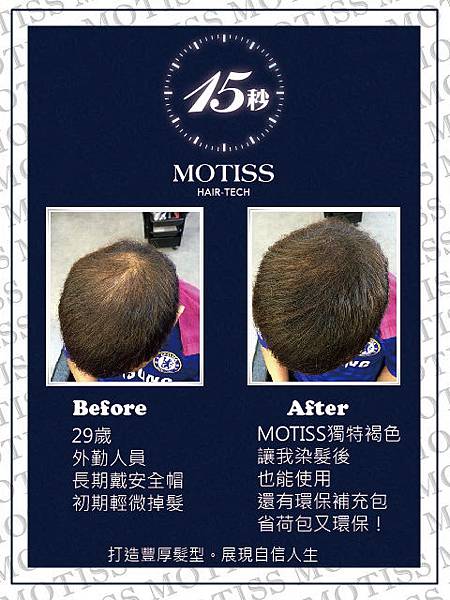 MOTISS豐髮纖維魔髮粉使用實例1