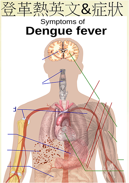 登革熱英文症狀