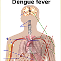 登革熱英文症狀