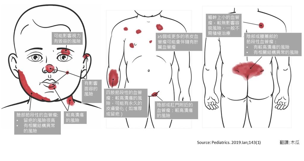 血管瘤治療適應症