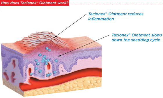 img_ointment_work.jpg