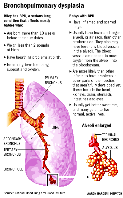 Bronchopulmonary_Dysplasia-1.gif