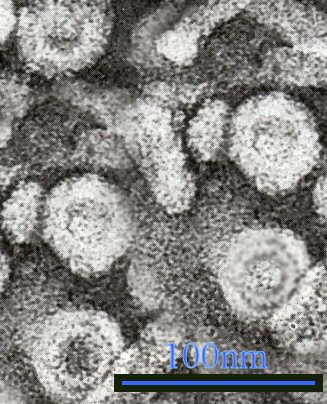 Hepatitis_B_virus_1