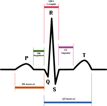 220px-SinusRhythmLabels.svg