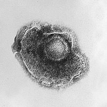 220px-Varicella_(Chickenpox)_Virus_PHIL_1878_lores.jpg