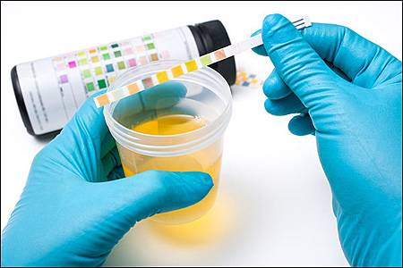 2-600-urinalysis