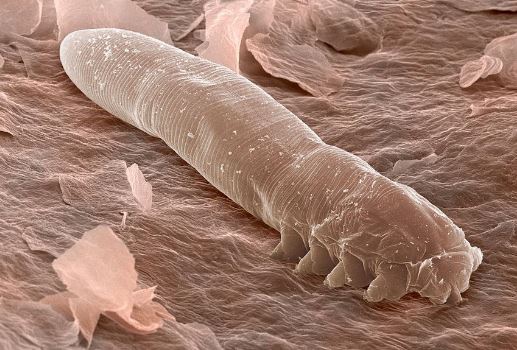 Eyelash-mites-under-a-microscope.jpg