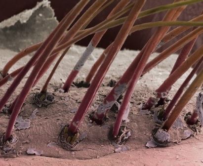 Eyelash-mites-on-hair-follicles-Courtesy-of-science-photo-library.jpg