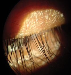 A treated eyelash.jpg