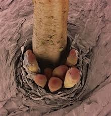 Eyelash-mites-infestation-on-eyelash-follicle.jpg