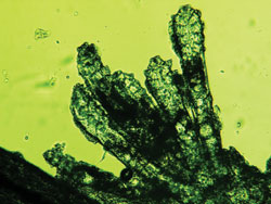 Two views of multiple mites coming from a collarette, and a single mite on the follicle2.jpg