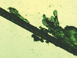 Two views of multiple mites coming from a collarette, and a single mite on the follicle1.jpg