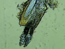 Two Demodex attached to the hair follicle root.jpg