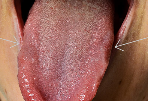 493ss_science_source_rm_scalloped_tongue.jpg