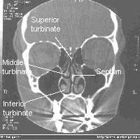 nasal-02.jpg~original.jpeg