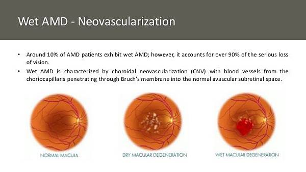 optimizing-image-guided-laserinduced-choroidal-neovascularization-in-mice-9-638