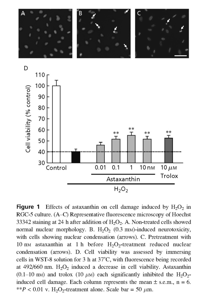 Astaxanthin, a dietary carotenoid, protects retinal cells against oxidative stress in-vitro and in mice in-vivo_頁面_04 - 複製.jpg Astaxanthin, a dietary carotenoid, protects retinal cells against oxidative stress in-vitro and in mice in-vivo_頁面_04 - 複製.jpg