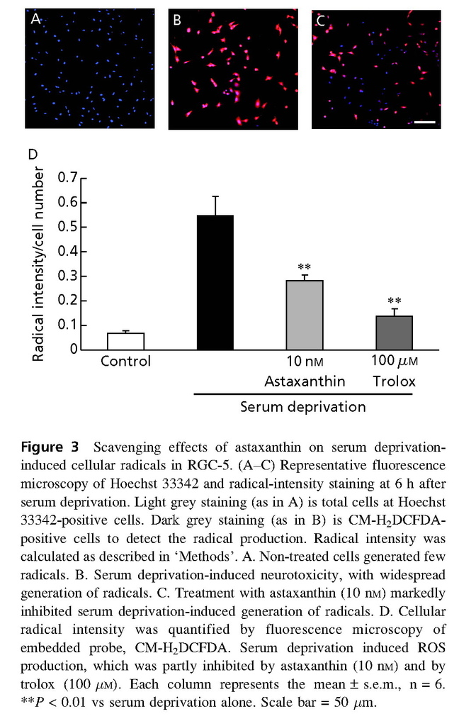 Astaxanthin, a dietary carotenoid, protects retinal cells against oxidative stress in-vitro and in mice in-vivo_頁面_05.jpg Astaxanthin, a dietary carotenoid, protects retinal cells against oxidative stress in-vitro and in mice in-vivo_頁面_05.jpg